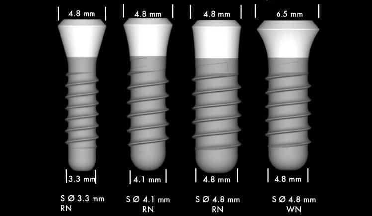 размеры зубных имплантов