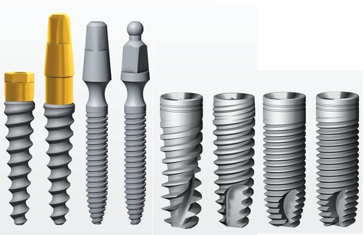 варианты имплантов